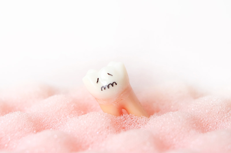 歯周病ってどんな病気？